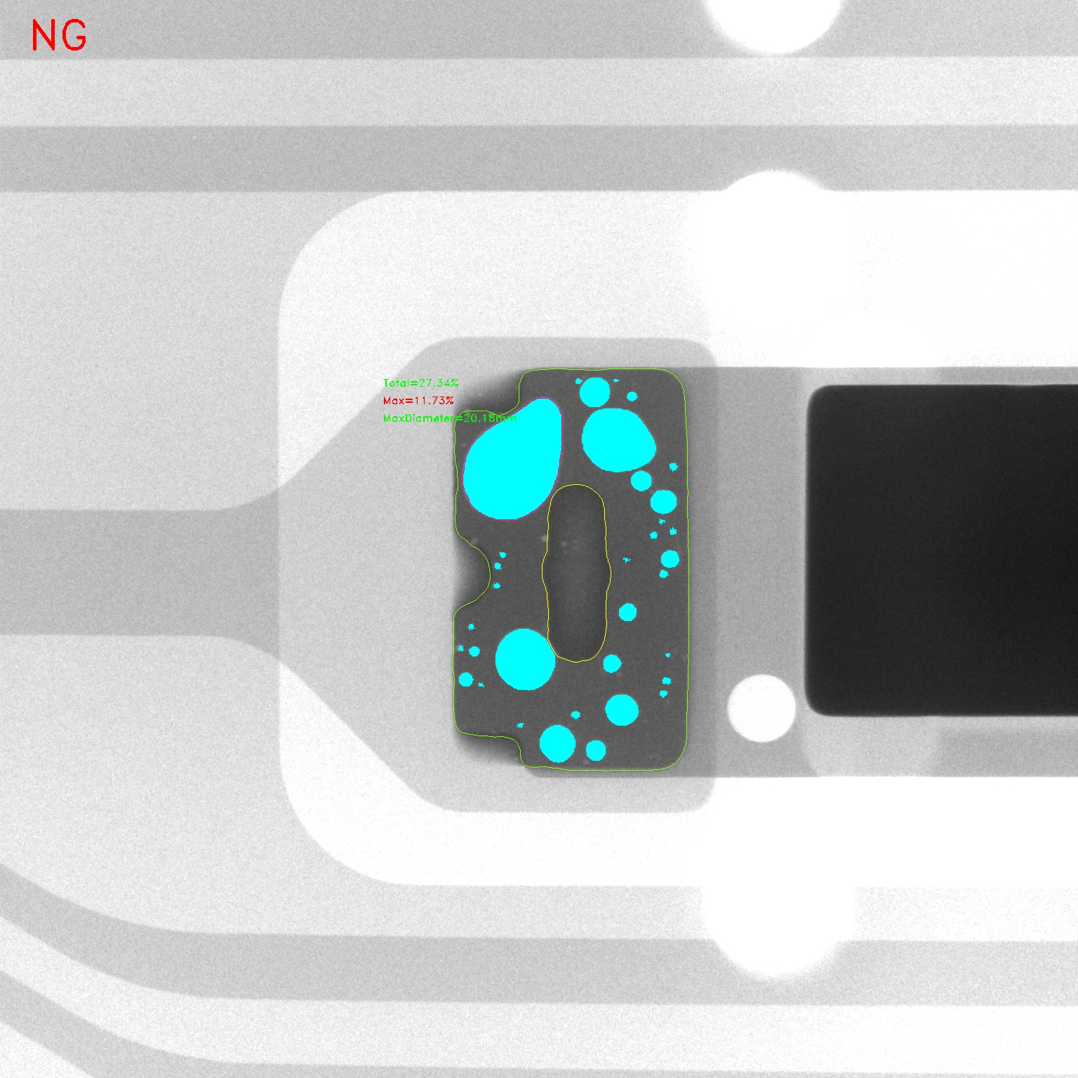 X-Ray Inline Inspection of SMT Mounting